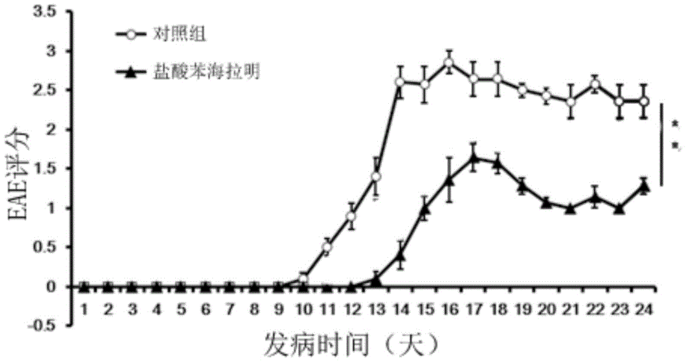 Application of diphenhydramine hydrochloride in preparation of medicine for treating experimental auto-immune encephalomyelitis