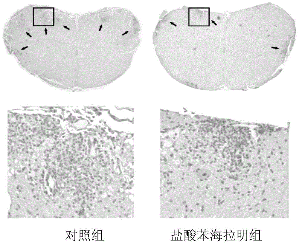 Application of diphenhydramine hydrochloride in preparation of medicine for treating experimental auto-immune encephalomyelitis