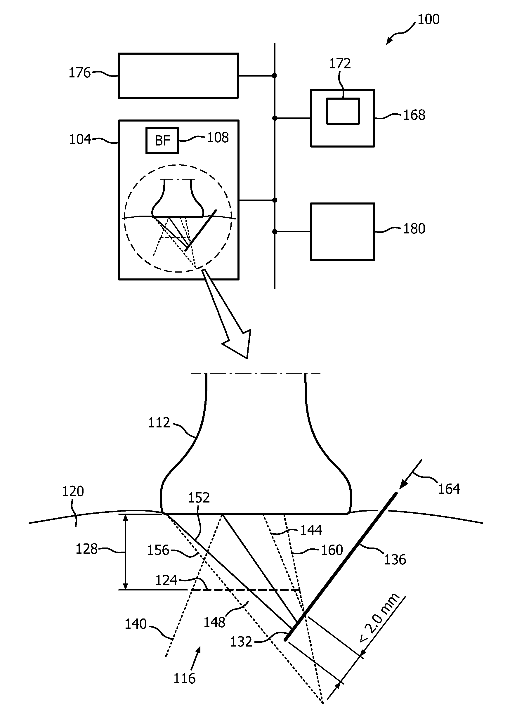 Automatic ultrasound beam steering and needle artifact suppression