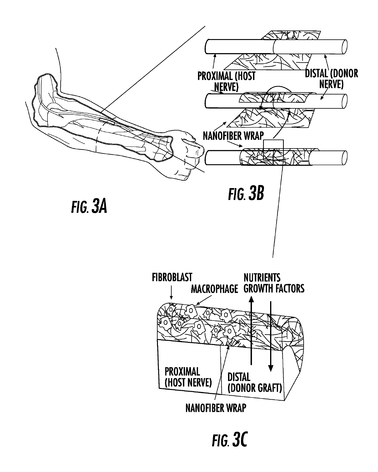 Device and method for a nanofiber wrap to minimize inflamation and scarring