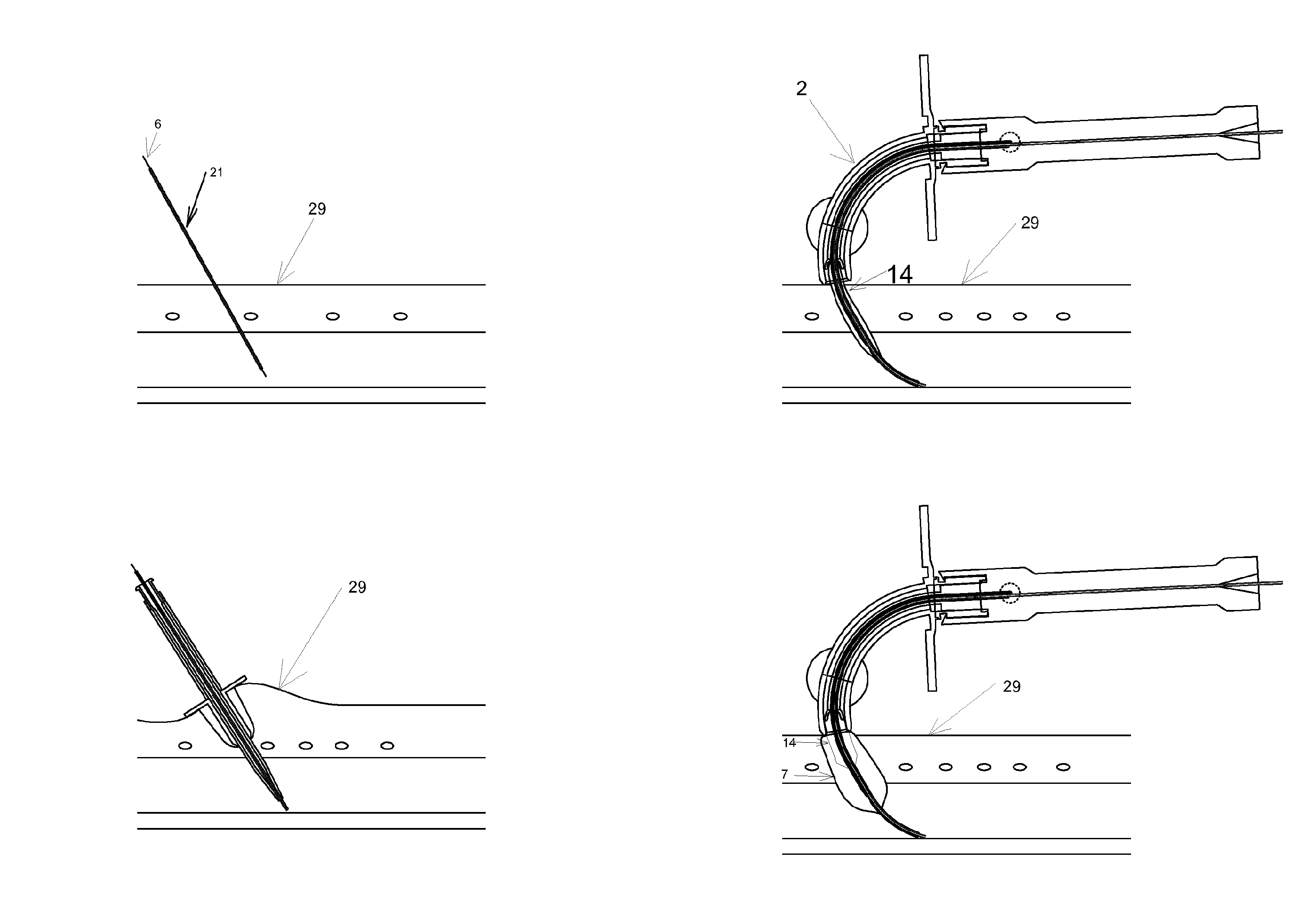 Dilatation system for a medical device