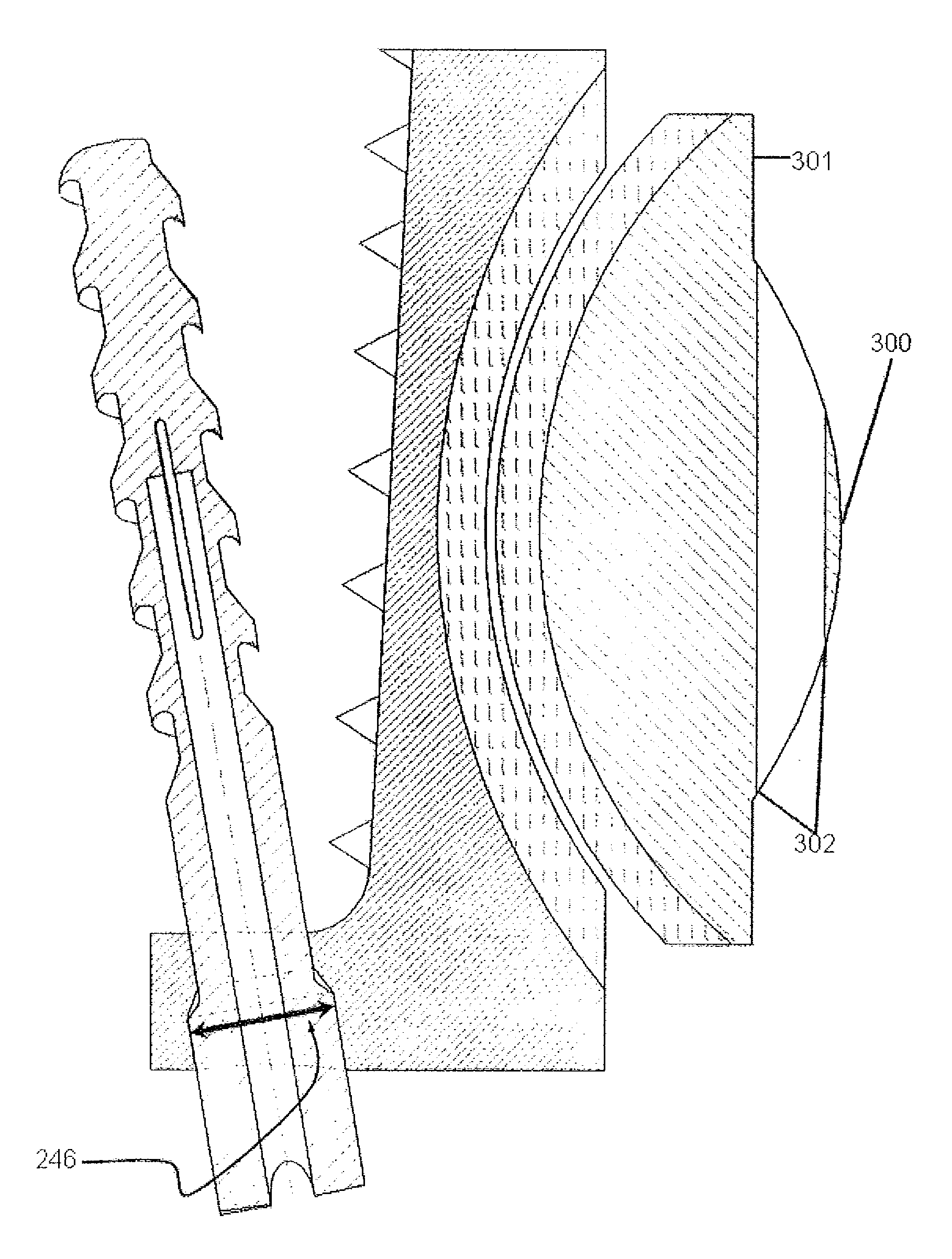 Dynamic spinal implants incorporating cartilage bearing graft material