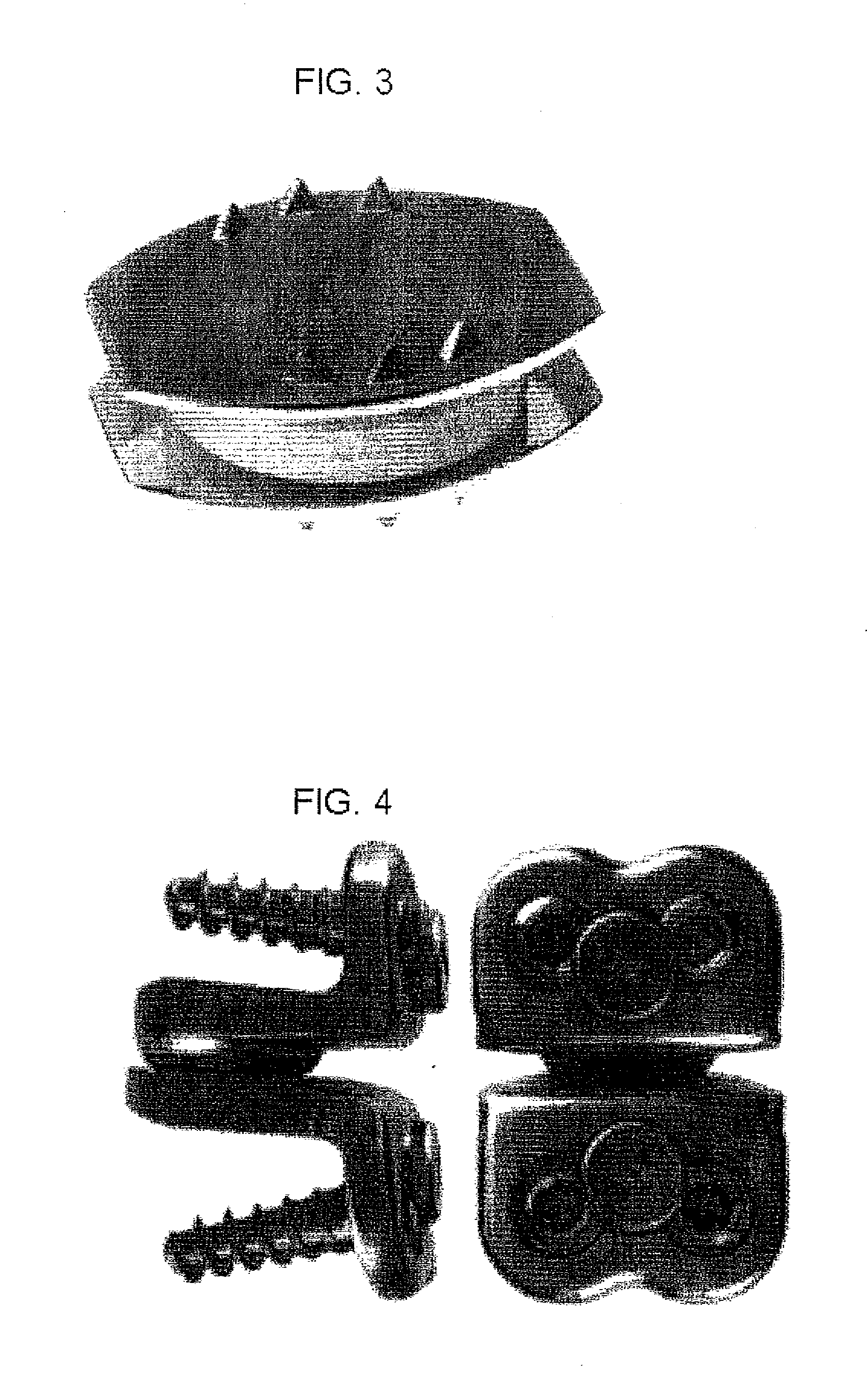 Dynamic spinal implants incorporating cartilage bearing graft material