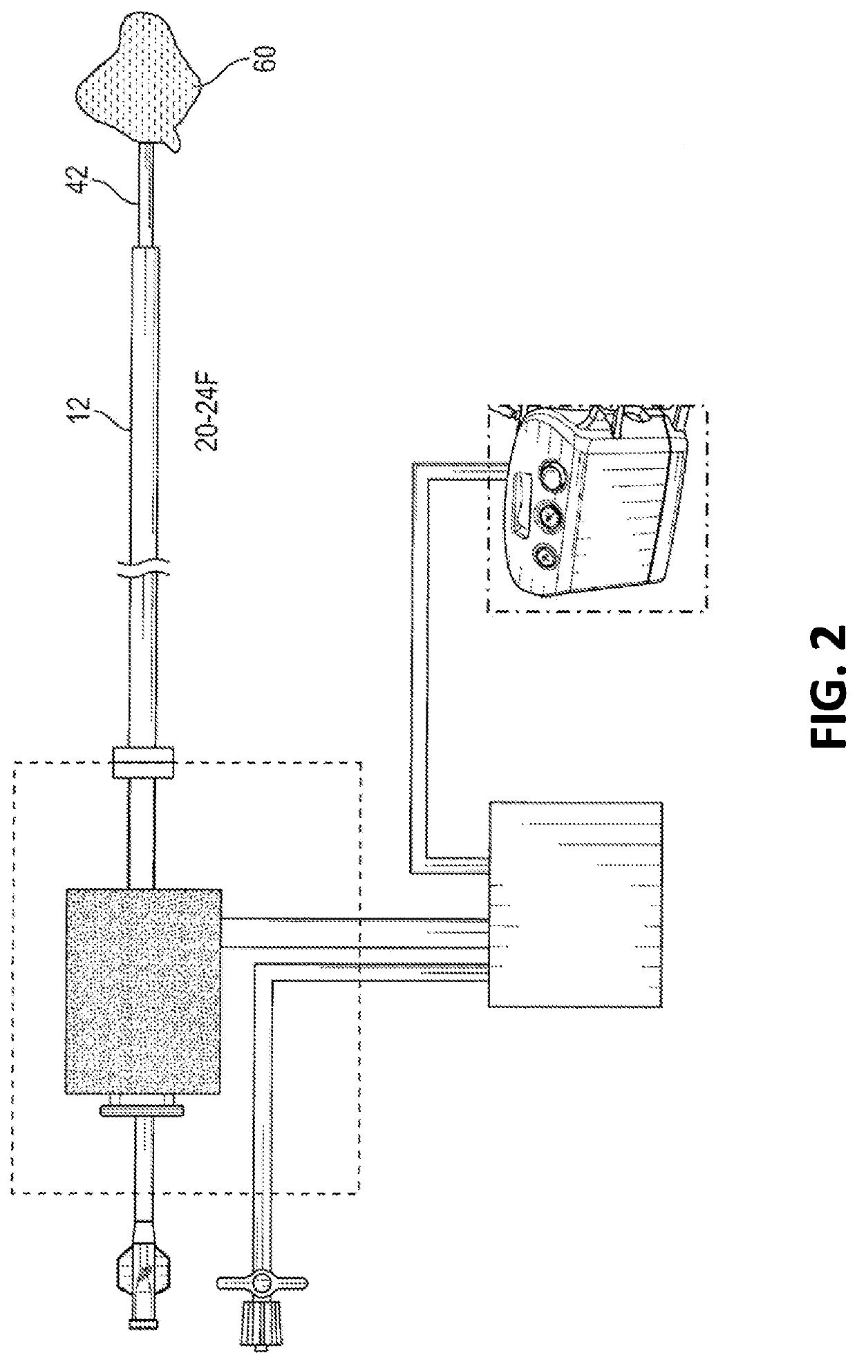 Methods of placing large bore aspiration catheters