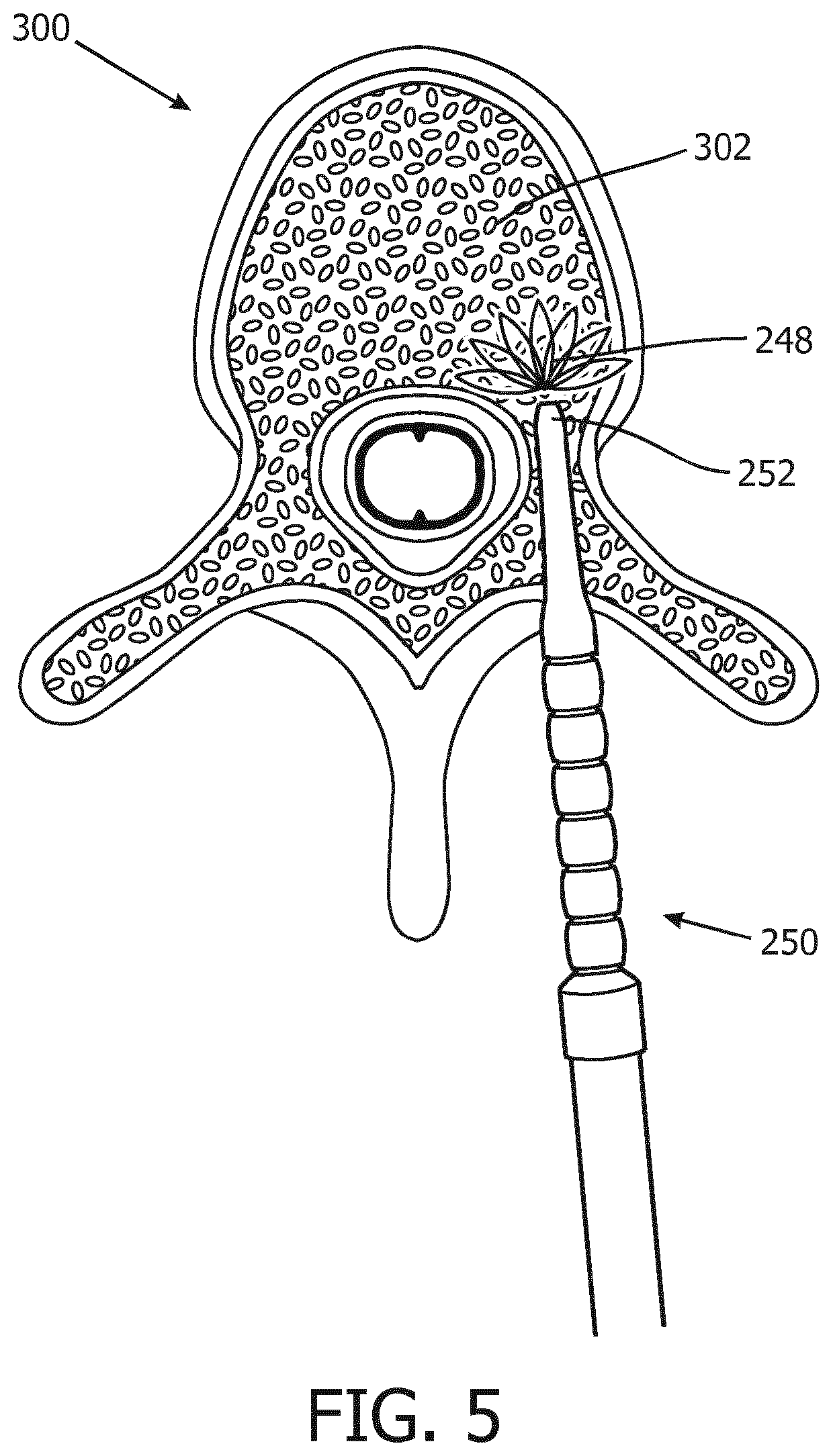 Position detection based on tissue discrimination