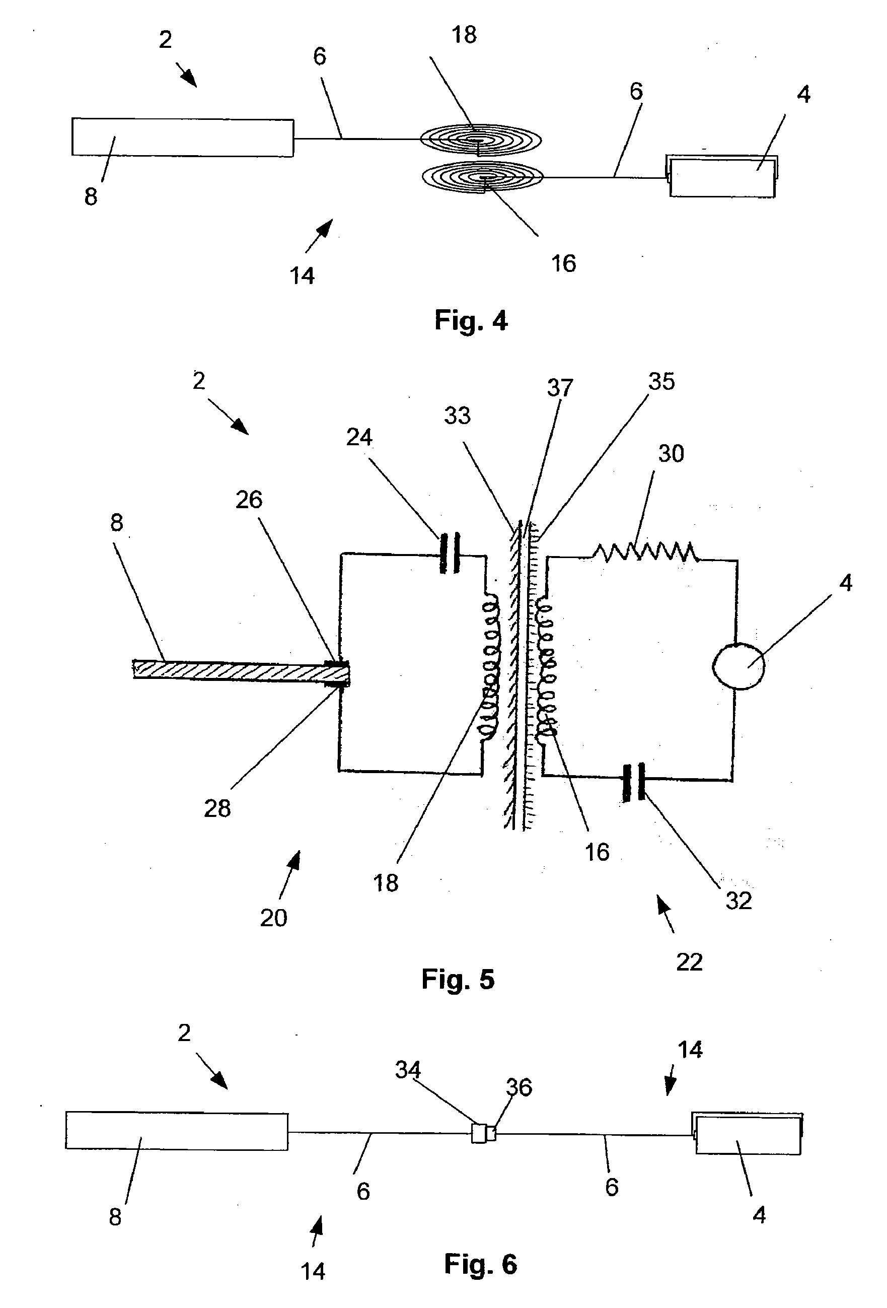 Implant for treatment of sleep disorders