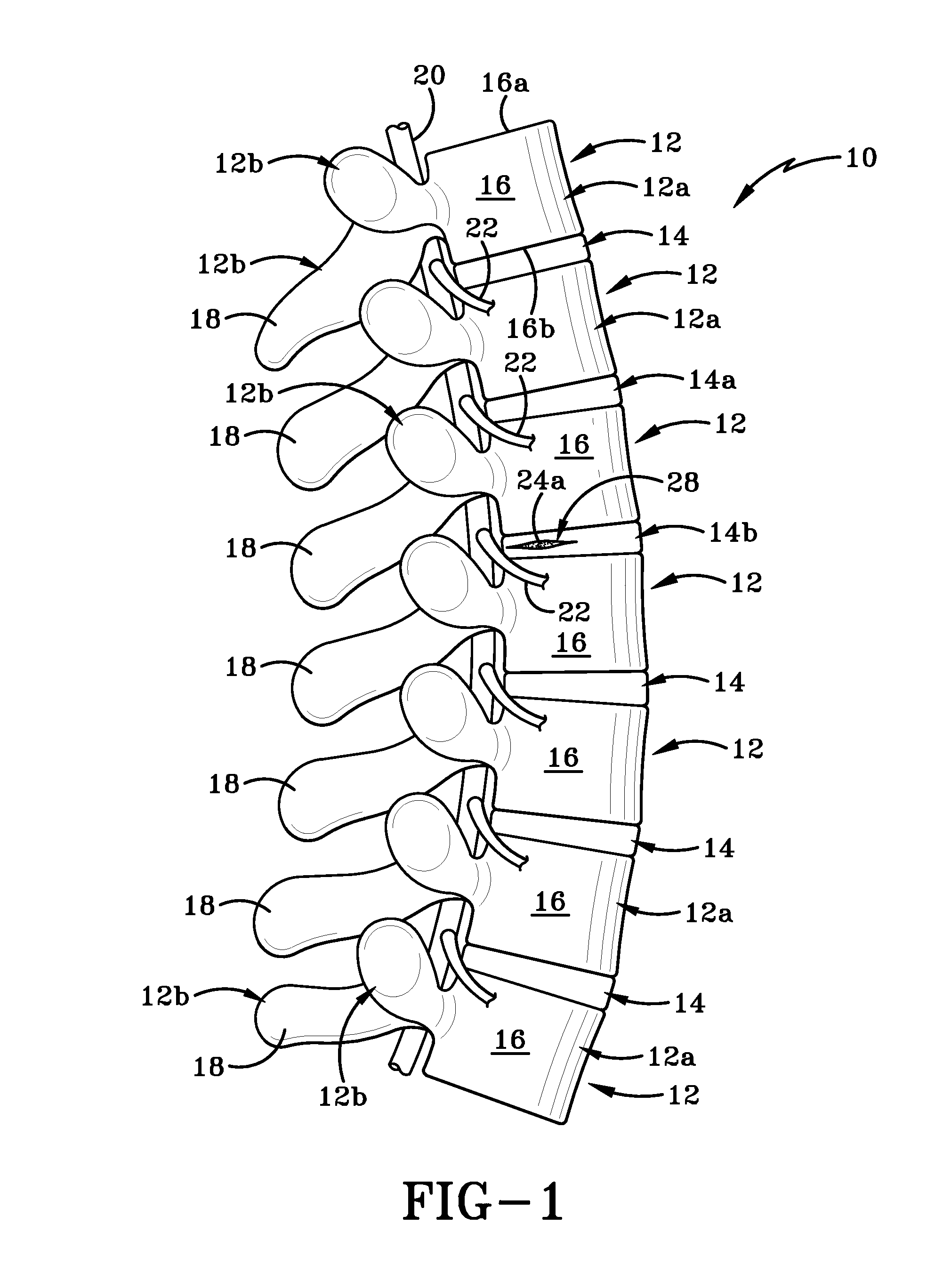 Nucleus pulposus spinal implant and method of using the same