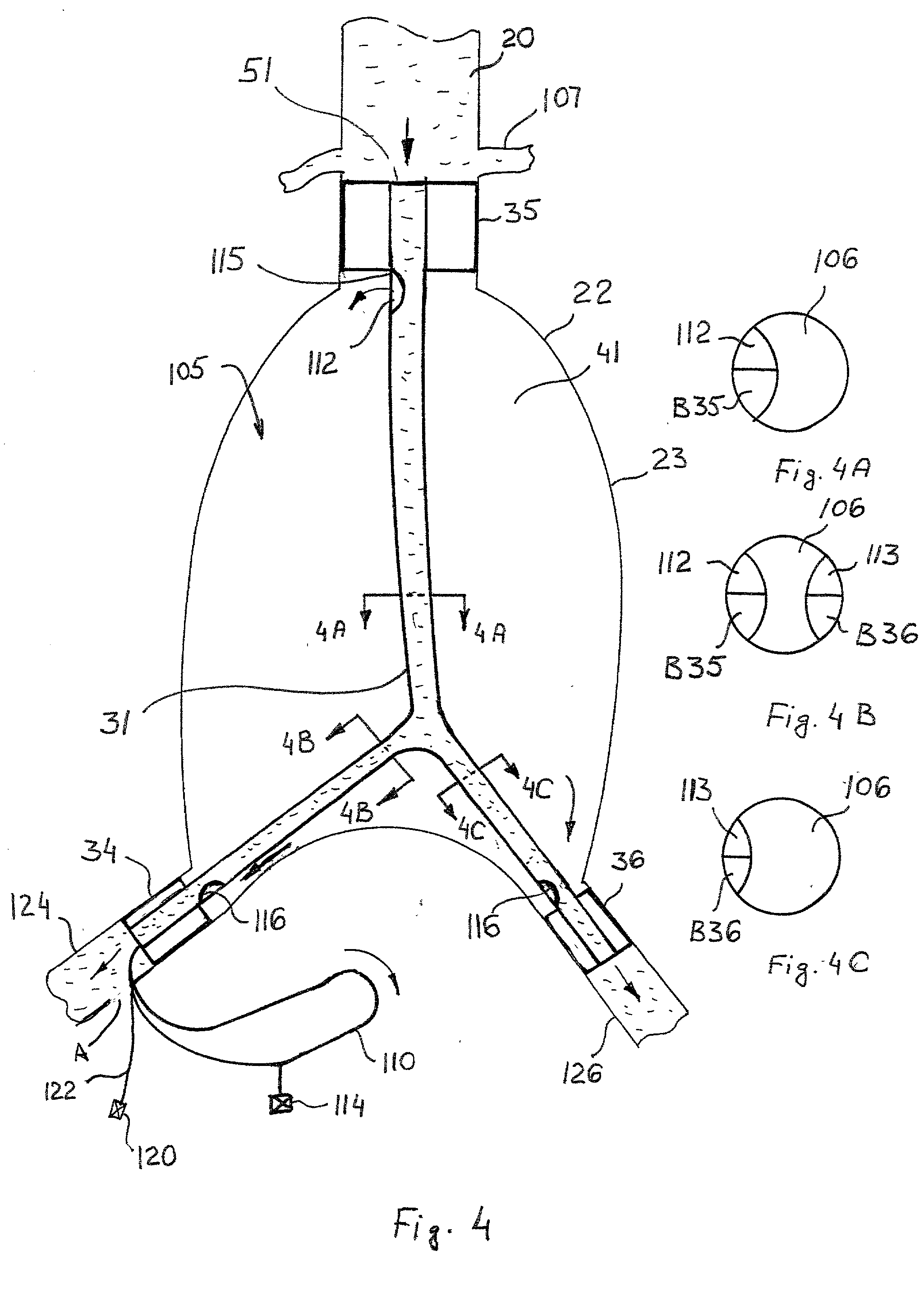 Method and apparatus for treating aneurysms