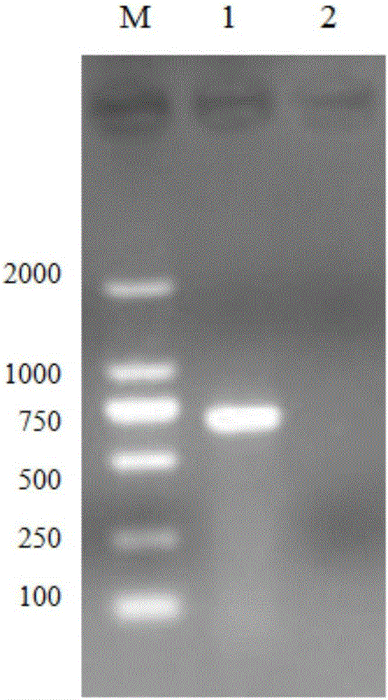 Primers, probe, kit and method for detecting bovine coronavirus