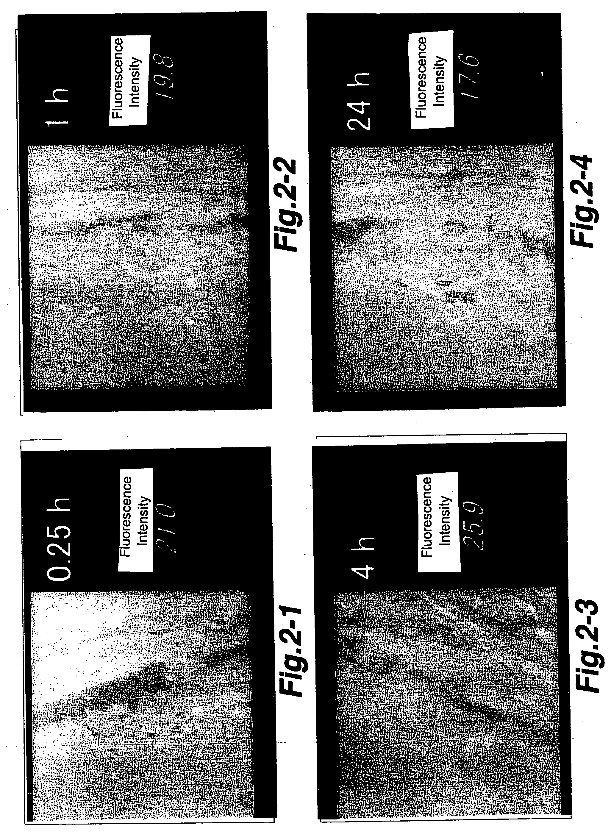 Ophthalmic drug delivery system using polymer micelle