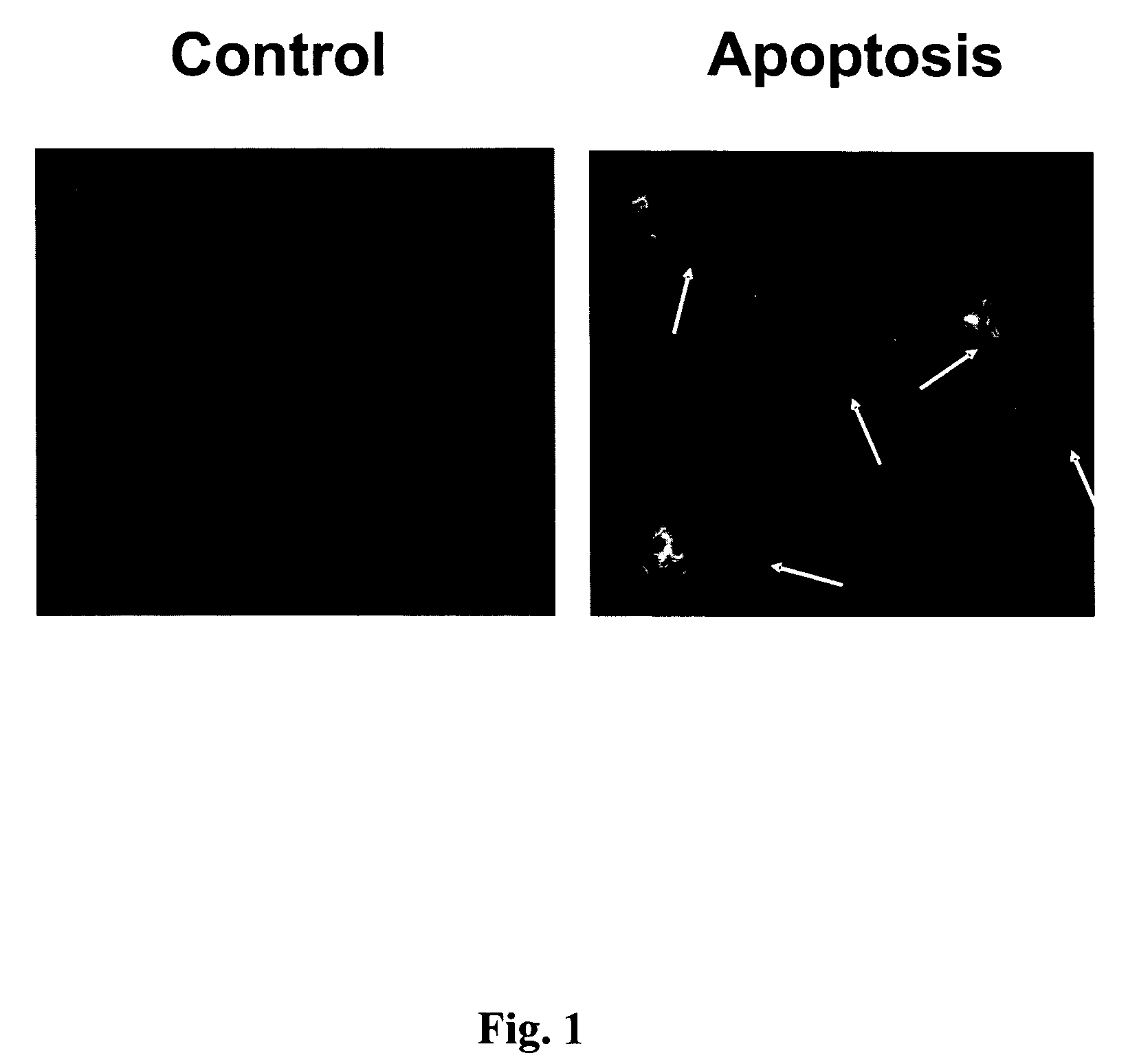 Compositions and methods for treatment of cardiovascular disorders and diseases