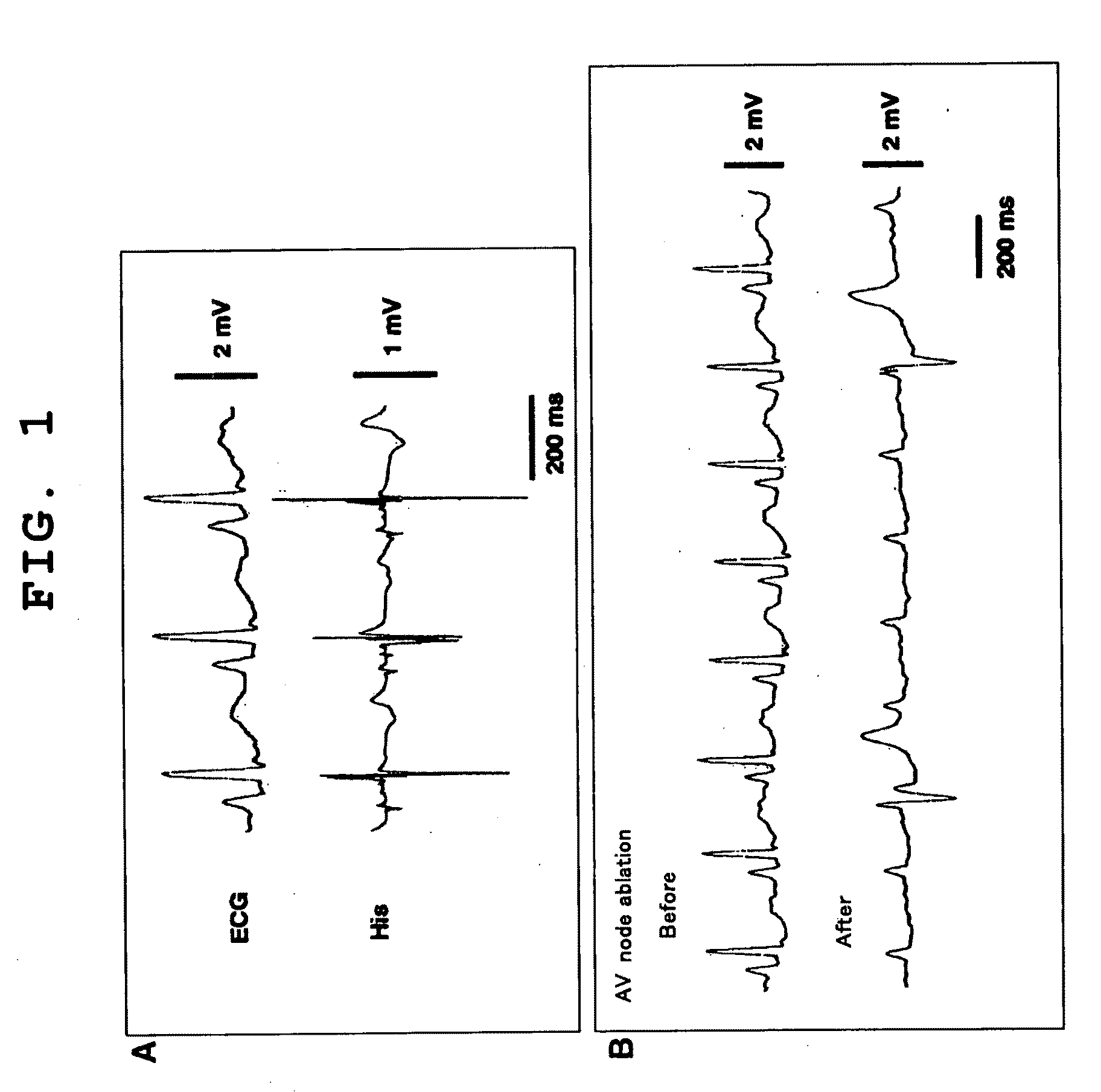 Animal Model With Induced Arrhythmia