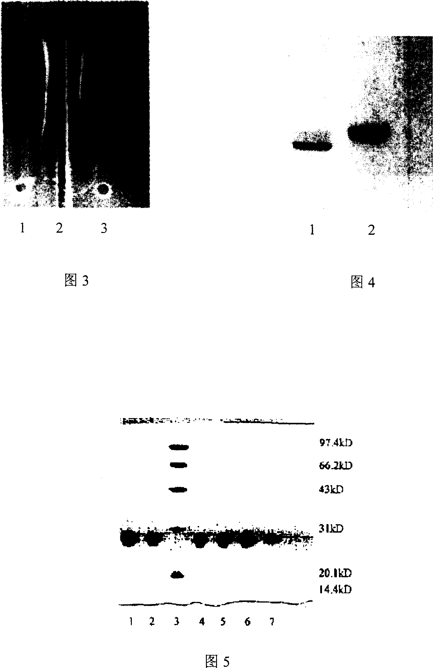 Human blood high density lipoprotein and its preparation method and use