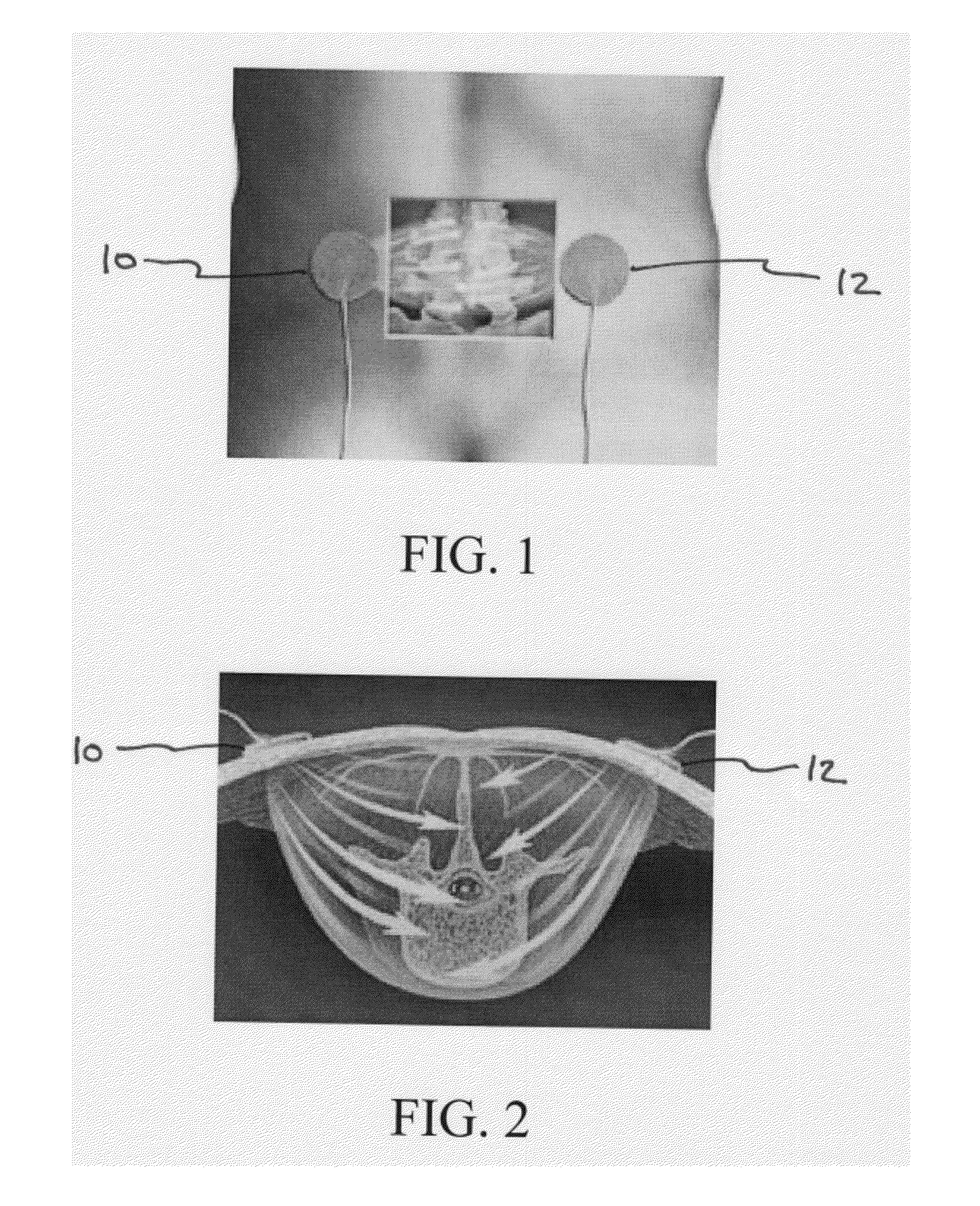 Method for treating degenerative disc disease using noninvasive capacitively coupled electrical stimulation device