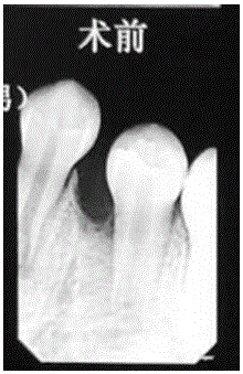 Dental pulp regeneration paste and preparing method thereof