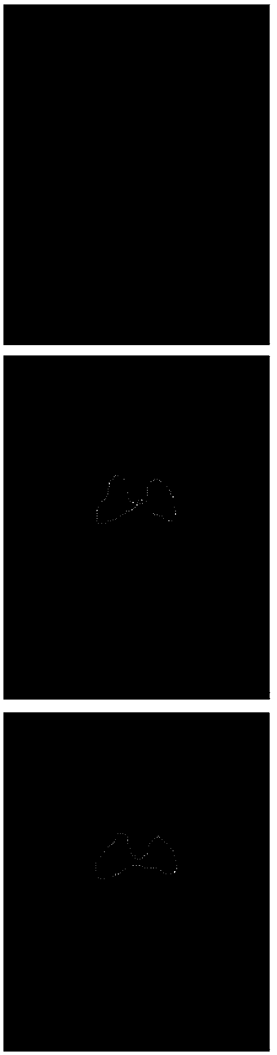 Method for automatically segmenting head and neck tumors in MRI image