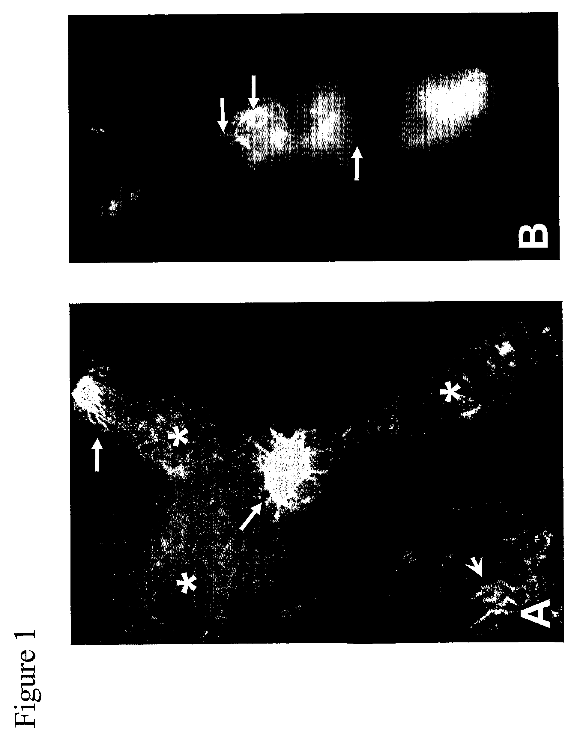 Microglia Facilitated Amyloidogenesis Assay