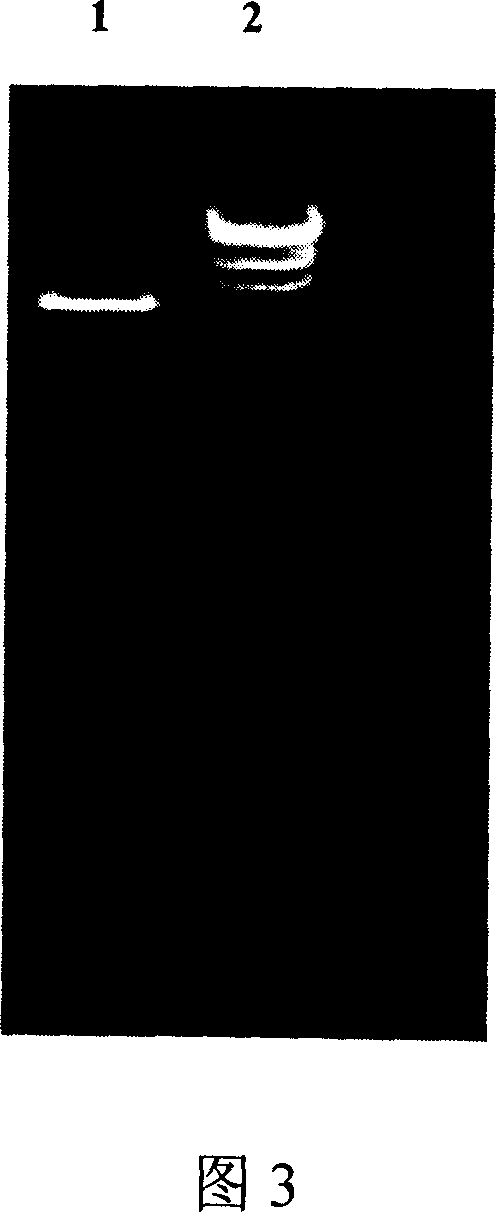 Ester hydrolase with R-isomer stereoselectivity, gene and recombination enzyme thereof