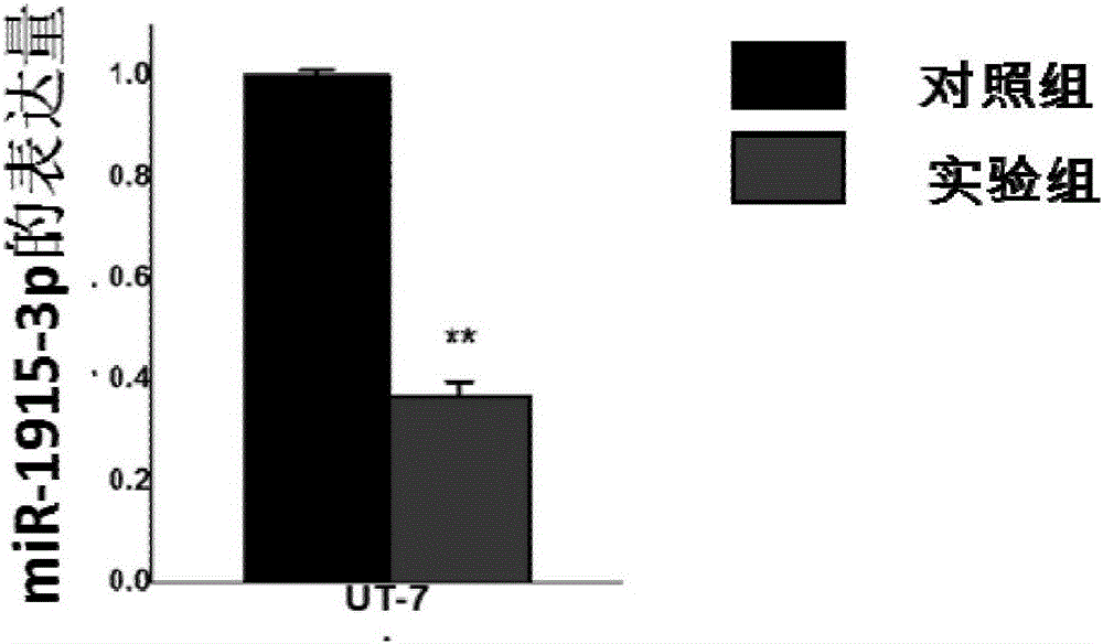 Nucleic acid and application thereof