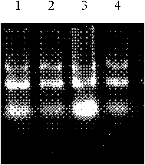 Eimeria tenella apical membrane antigen 1 (AMA 1) gene and application thereof