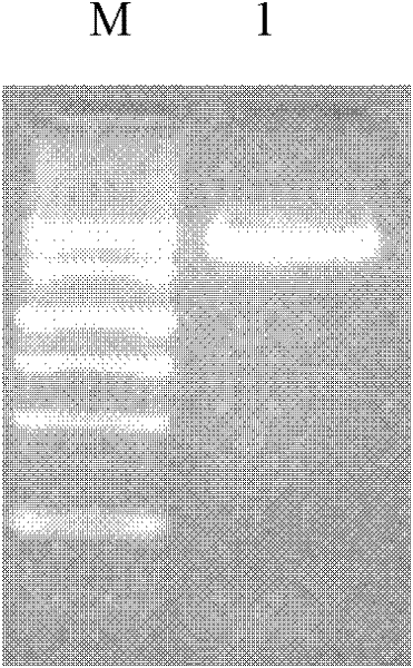 Eimeria tenella apical membrane antigen 1 (AMA 1) gene and application thereof