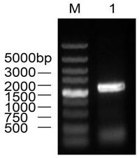 Preparation method and application of a candidate outer membrane protein of Aeromonas hydrophila vaccine