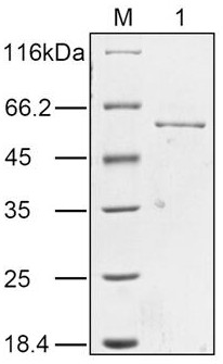 Preparation method and application of a candidate outer membrane protein of Aeromonas hydrophila vaccine