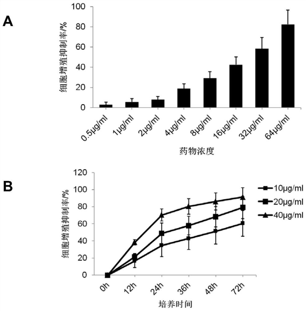 Application of glabridin in preparation of medicine for treating rheumatoid arthritis