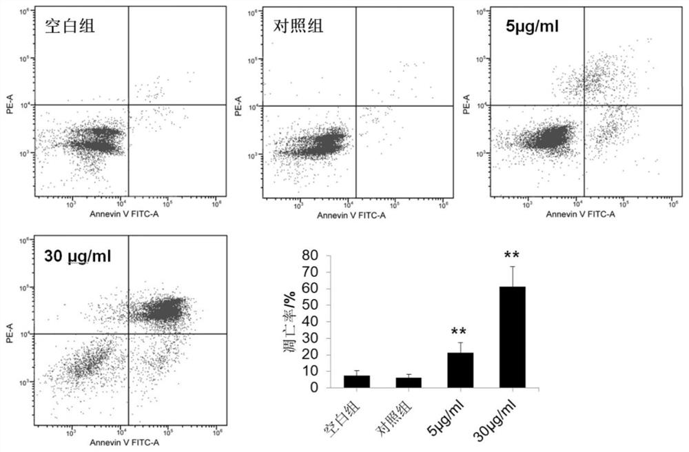 Application of glabridin in preparation of medicine for treating rheumatoid arthritis