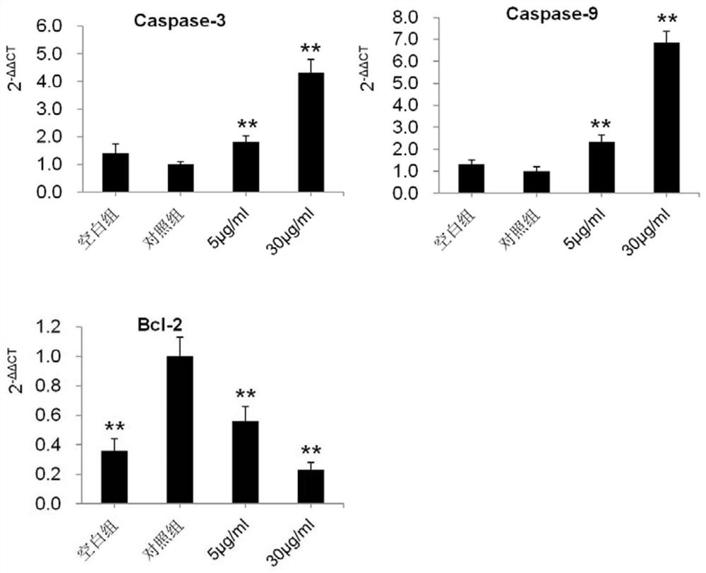 Application of glabridin in preparation of medicine for treating rheumatoid arthritis