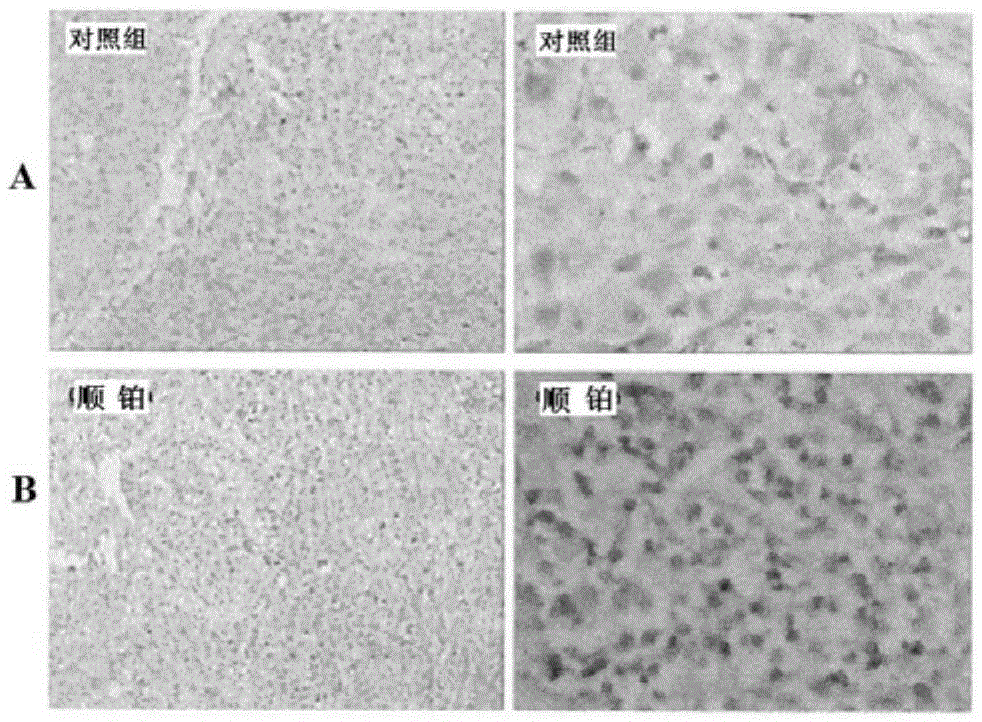 Positron-nuclide-labeled dansyl amido diphenylethylene compound and synthesis method and application thereof