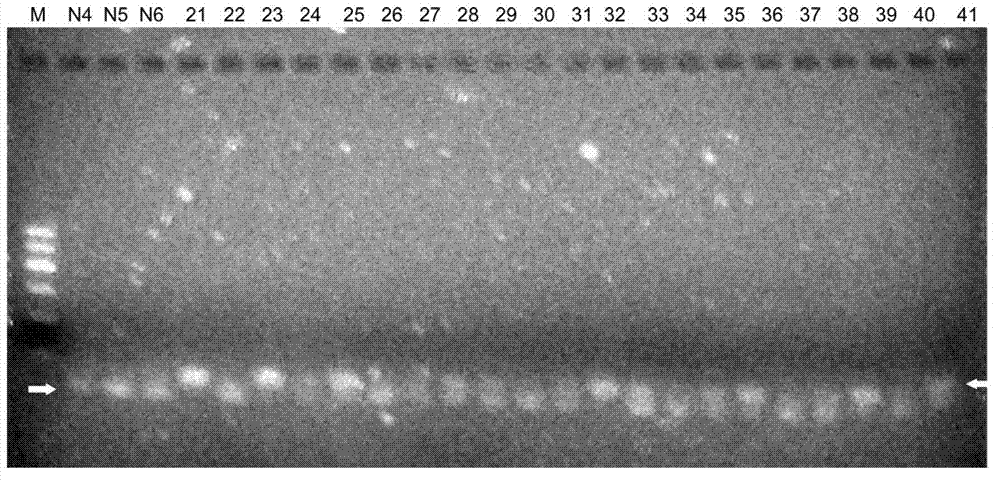 AETCA (anchored-extension and telomeric complements amplification) detection reagent kit for telomerase and detection method