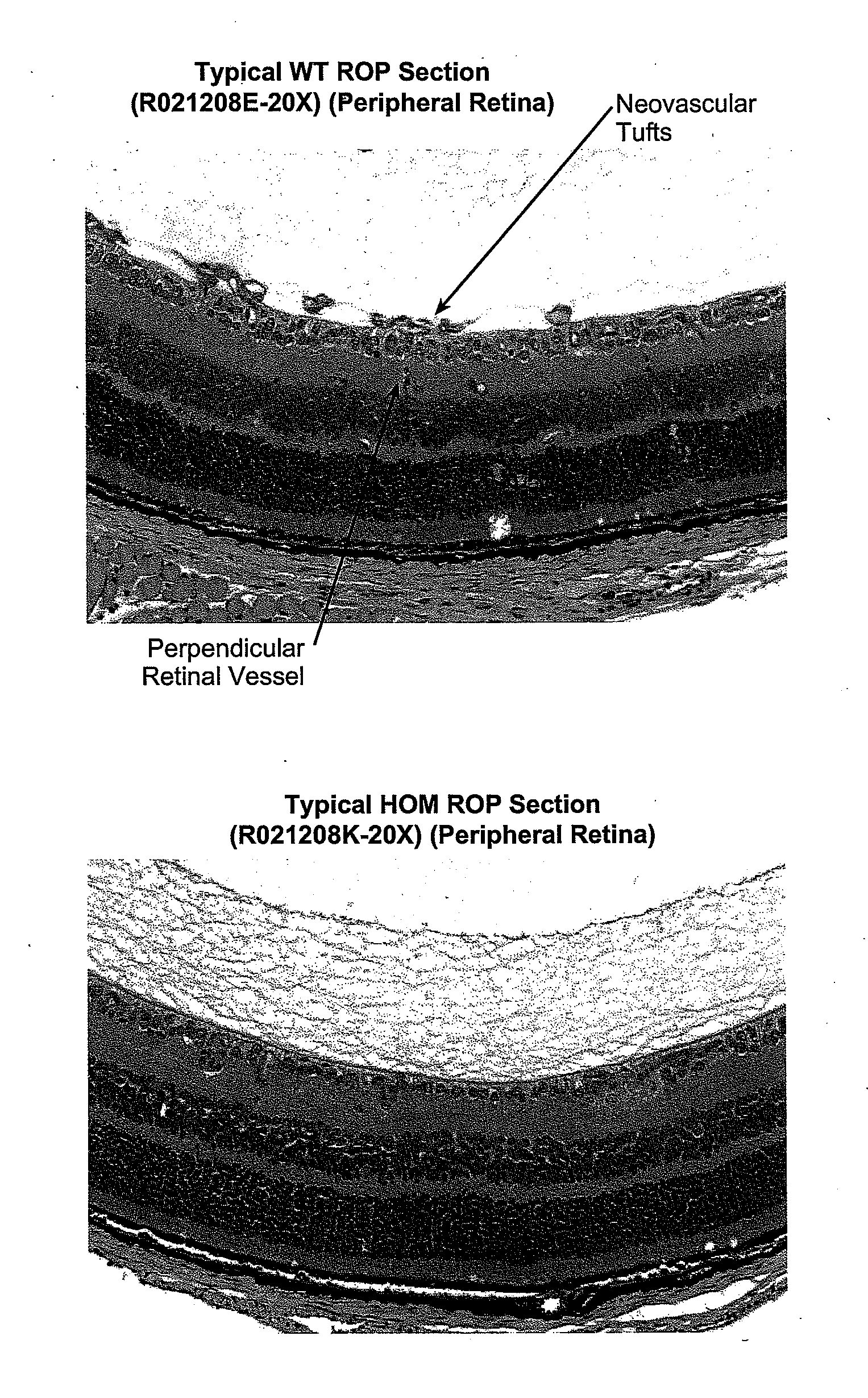 Methods for inhibiting ocular angiogenesis