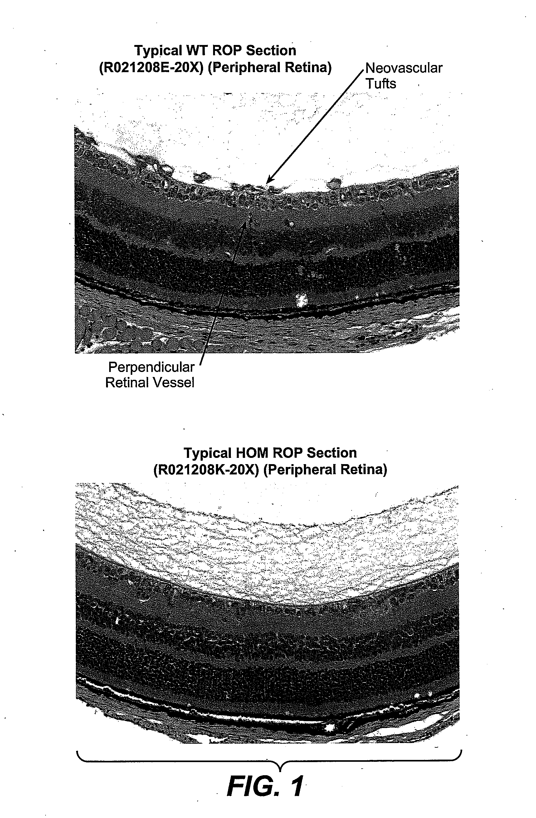 Methods for inhibiting ocular angiogenesis