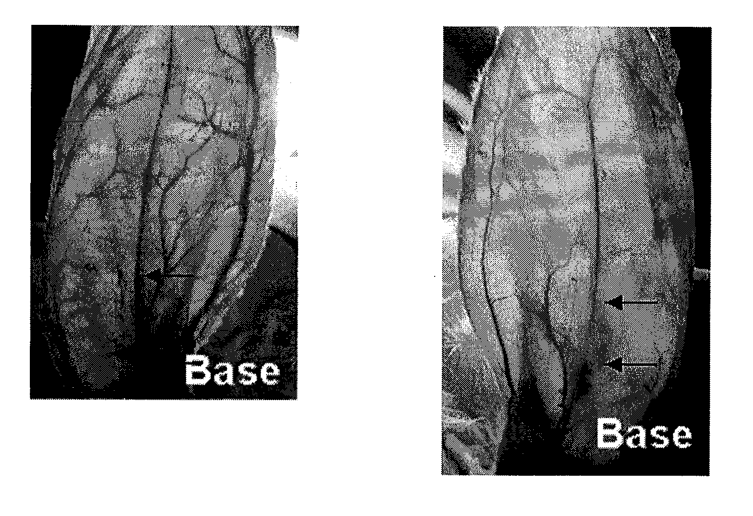 Prostaglandin compositions and methods for the treatment of vasospasm