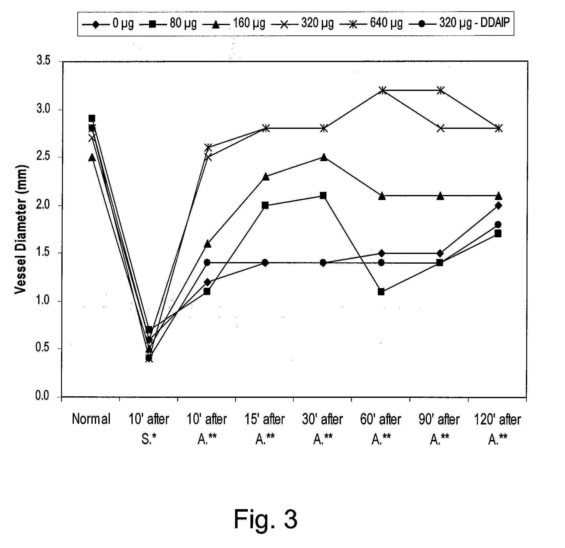 Prostaglandin compositions and methods for the treatment of vasospasm