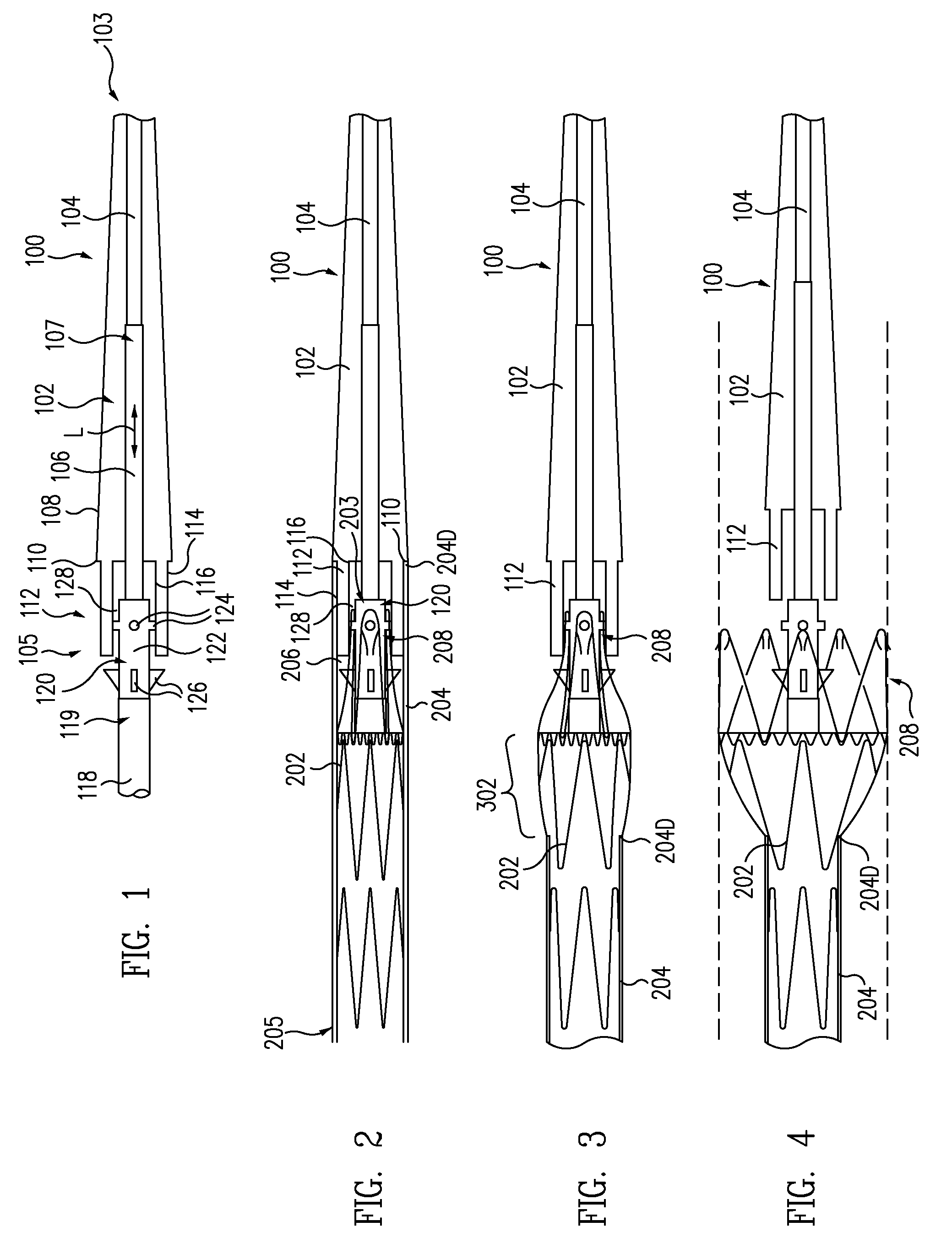 Stent-graft with anchoring pins