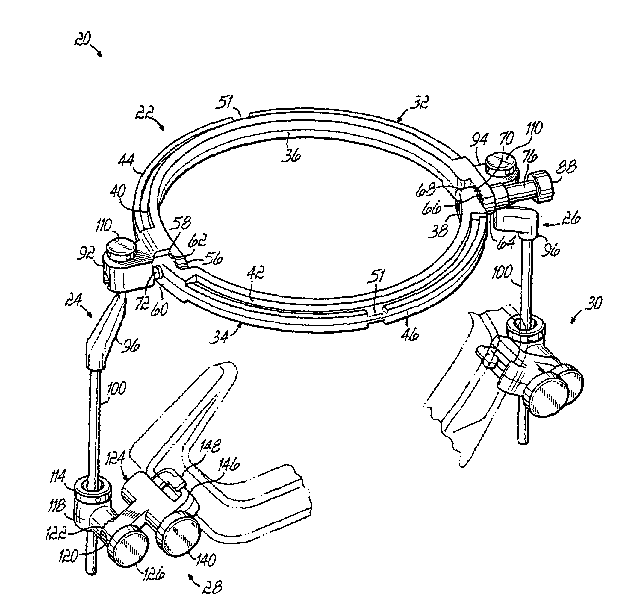 Radiolucent retractor and related components