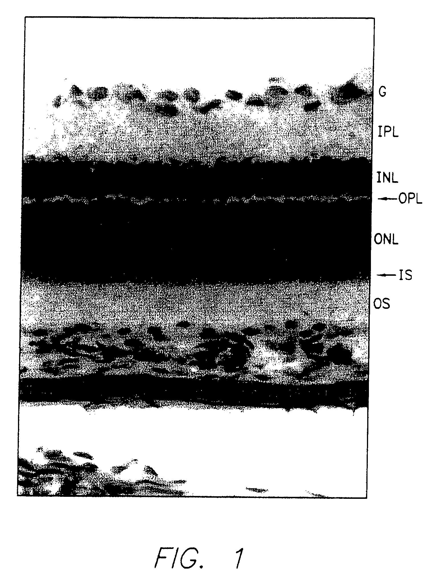 Retinal cell grafts and instrument for implanting