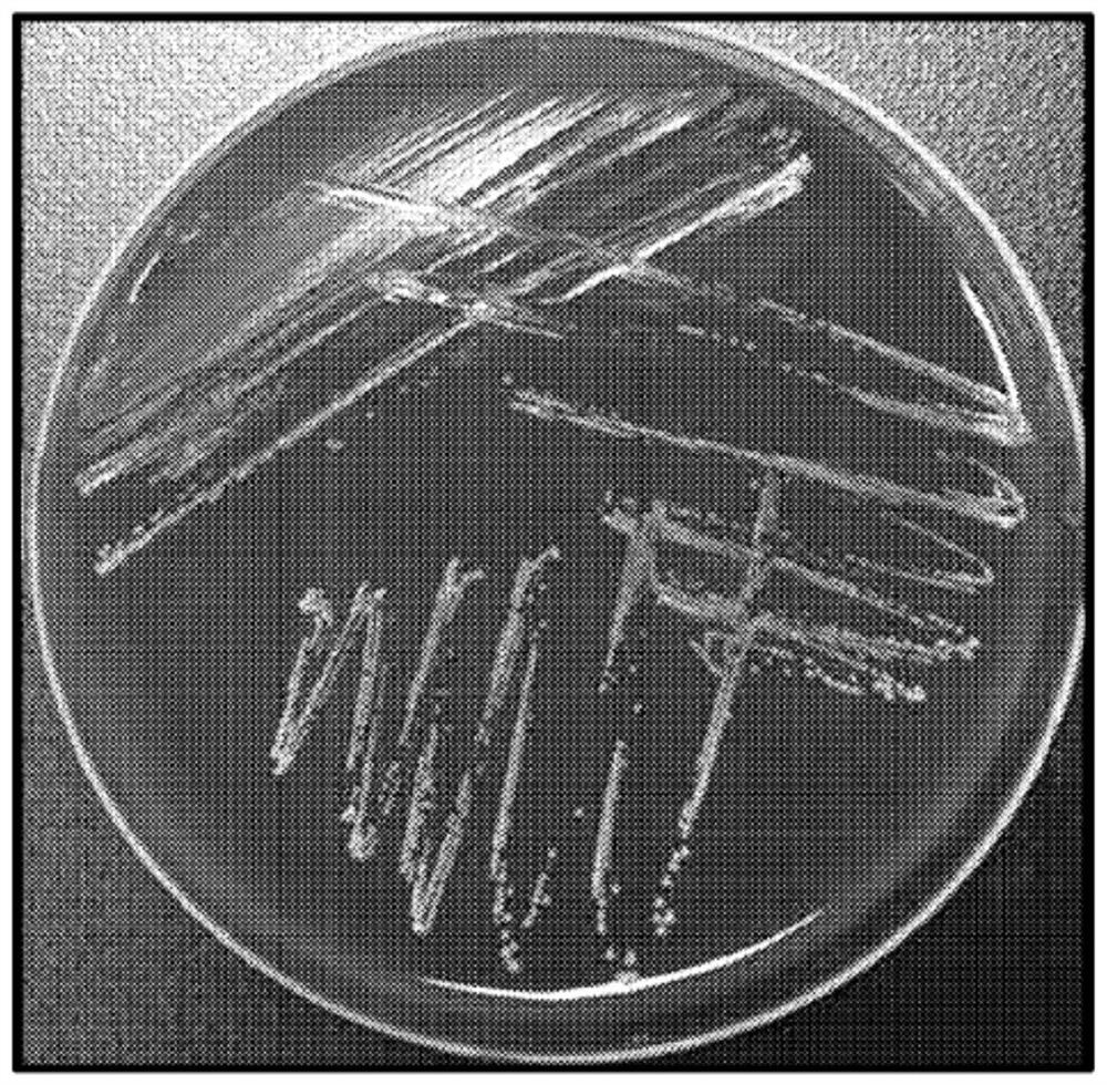 Novel cutibacterium avidum strain, and composition for preventing or treating atopic dermatitis, comprising strain or cultured product thereof