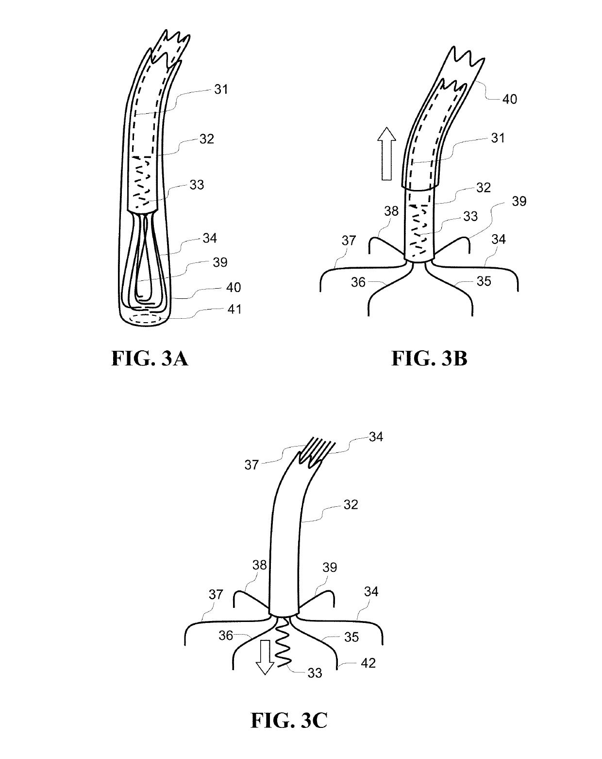 Single conduit multi-electrode cardiac pacemaker and methods of using thereof