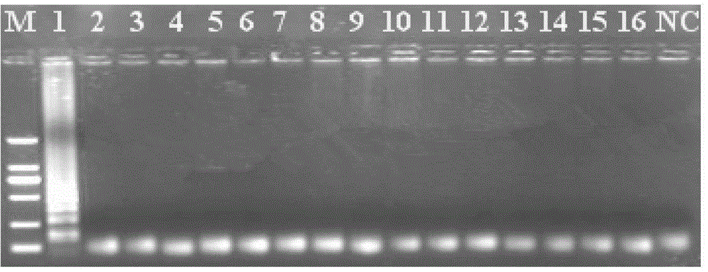 LAMP (loop-mediated isothermal amplification) detection kit of vibrio parahaemolyticus and detection method thereof