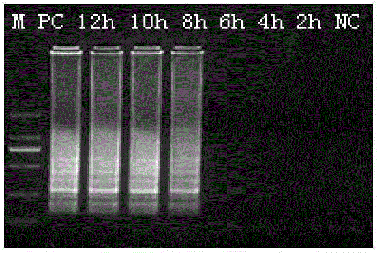 LAMP (loop-mediated isothermal amplification) detection kit of vibrio parahaemolyticus and detection method thereof