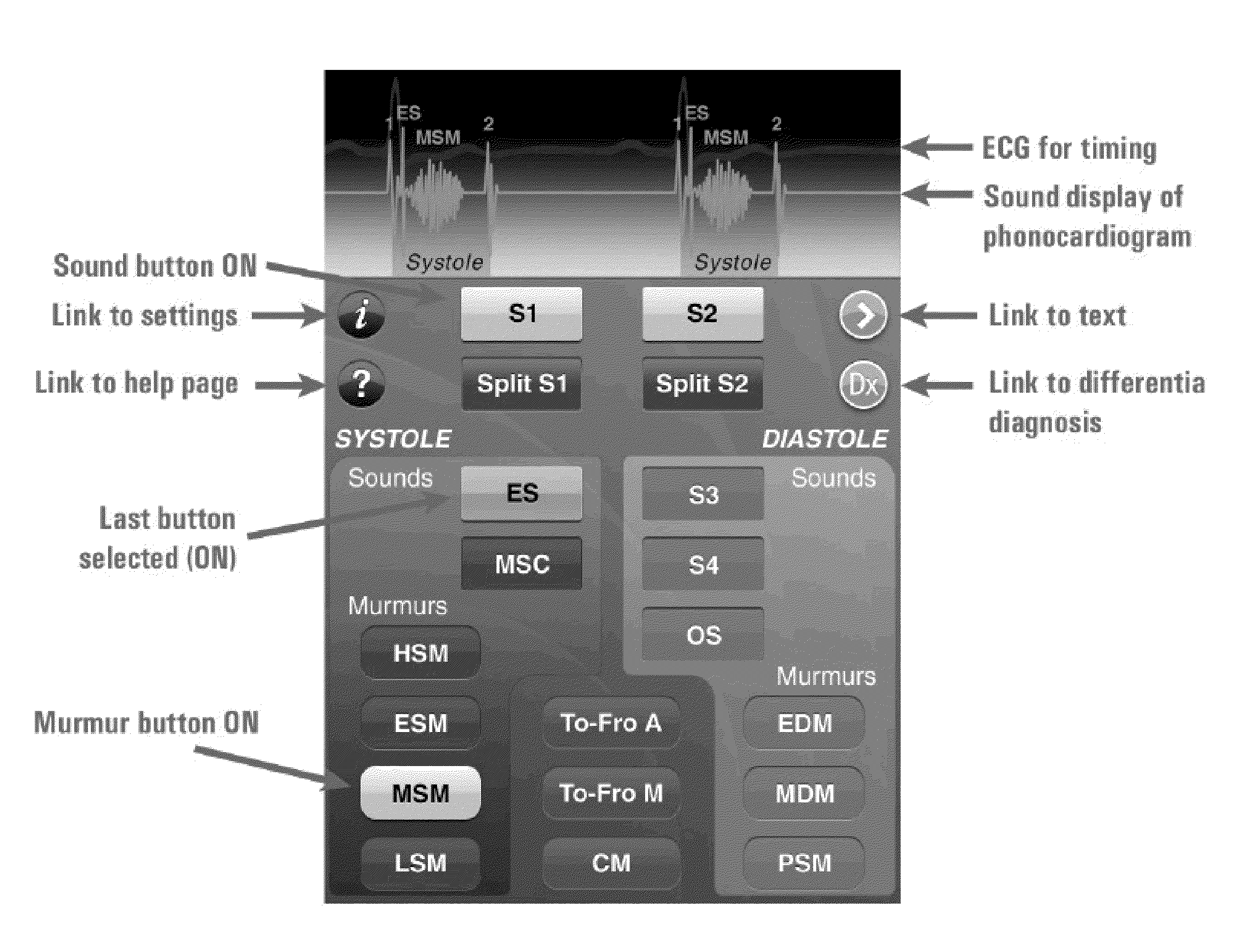 Method and system for identifying cardiopulmonary findings by using a heart and lung sounds builder