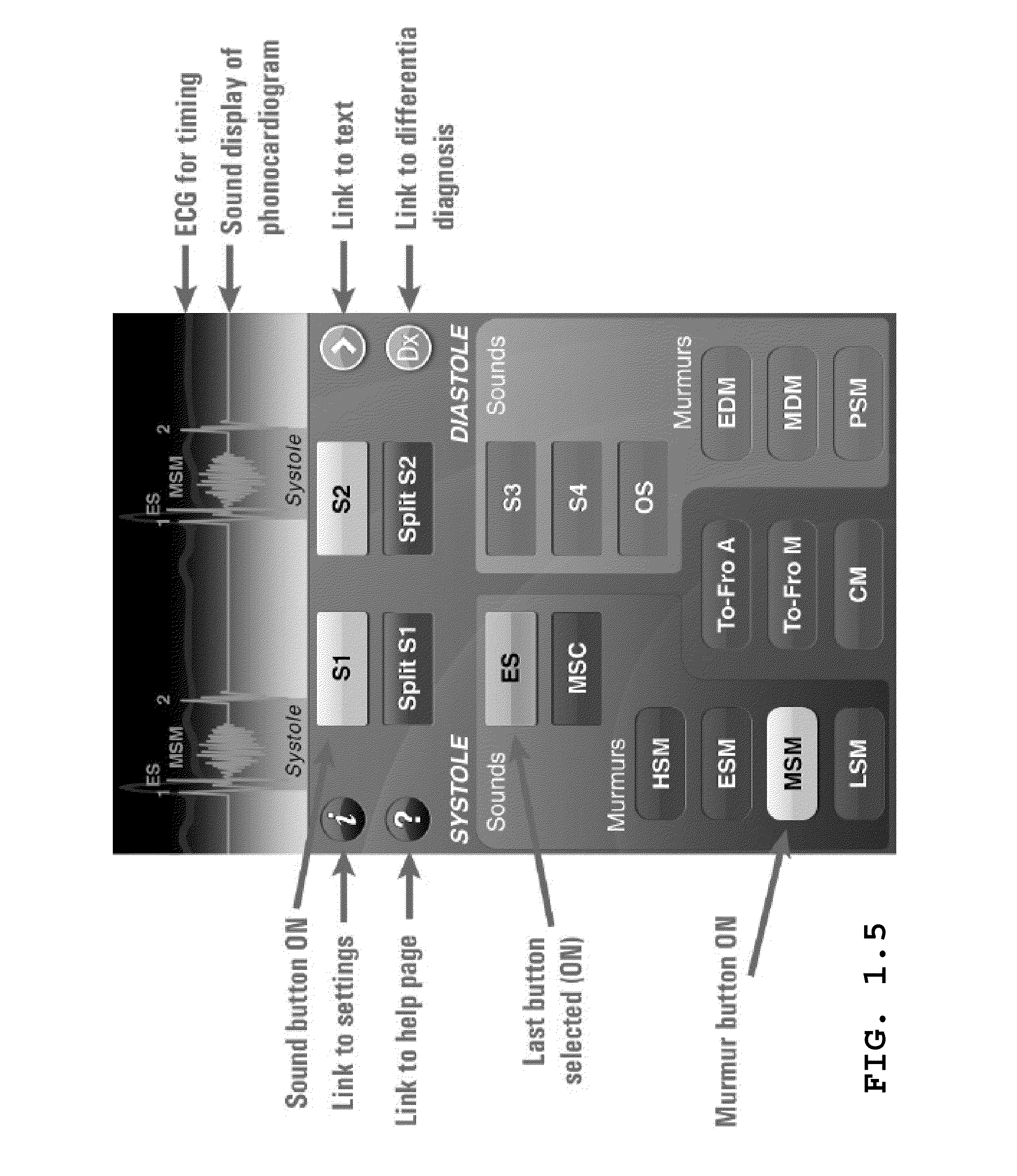 Method and system for identifying cardiopulmonary findings by using a heart and lung sounds builder