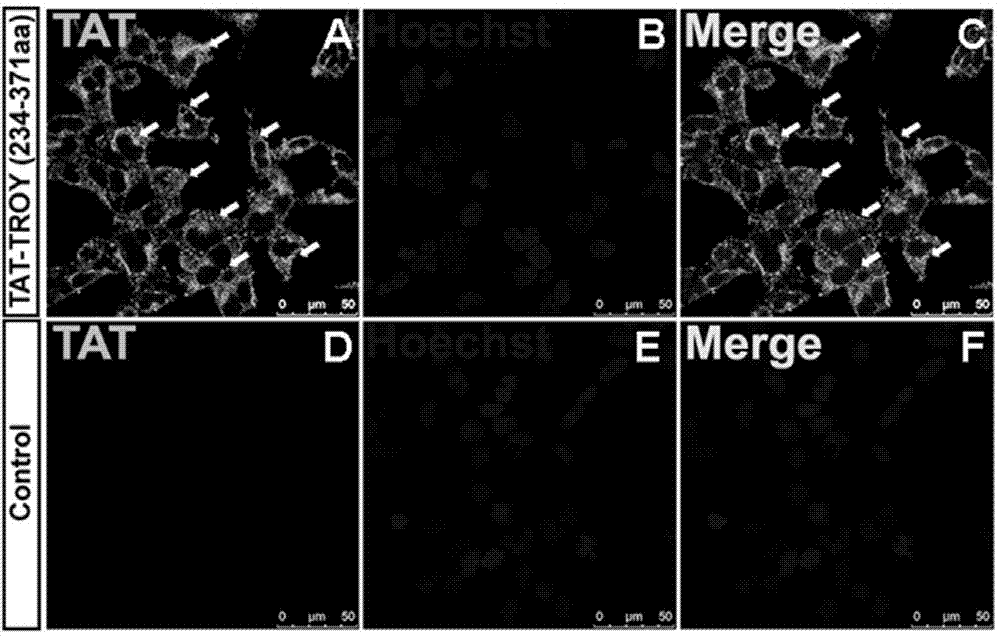 Application of polypeptide in preparation of drug for preventing and treating glioblastoma