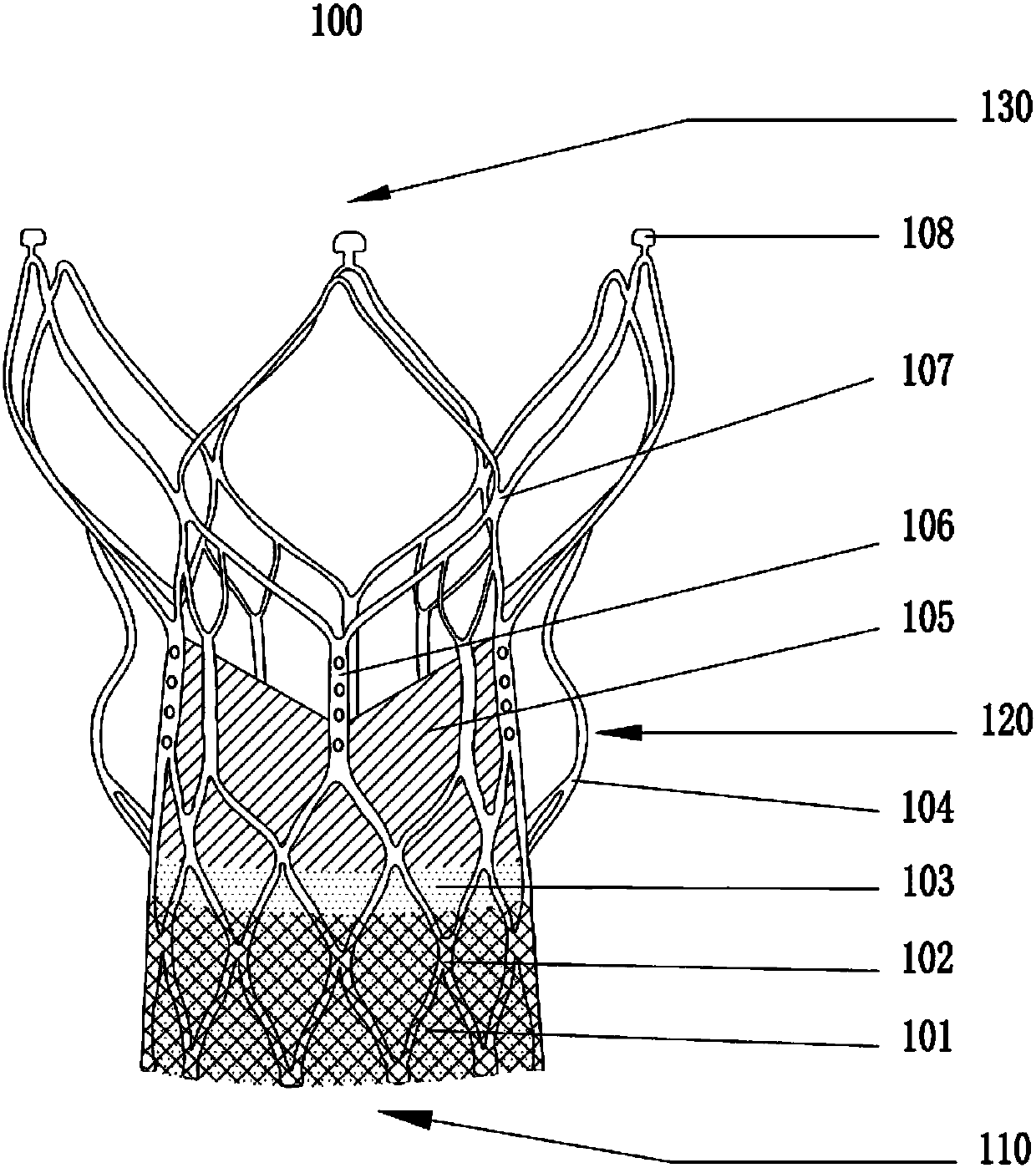 Device capable of locating and recycling transcatheter implantable aortic valve