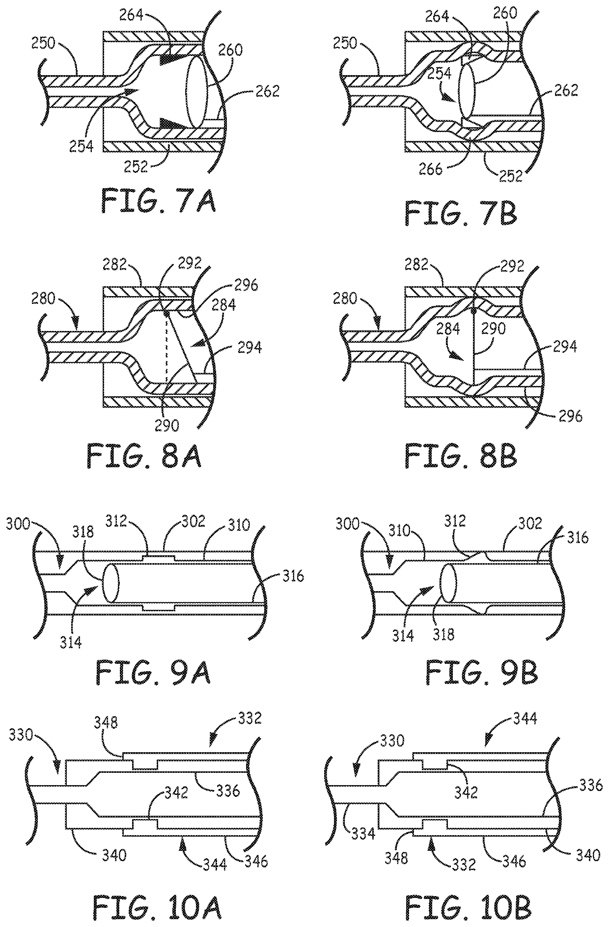 Catheter systems for applying effective suction in remote vessels and thrombectomy procedures facilitated by catheter systems