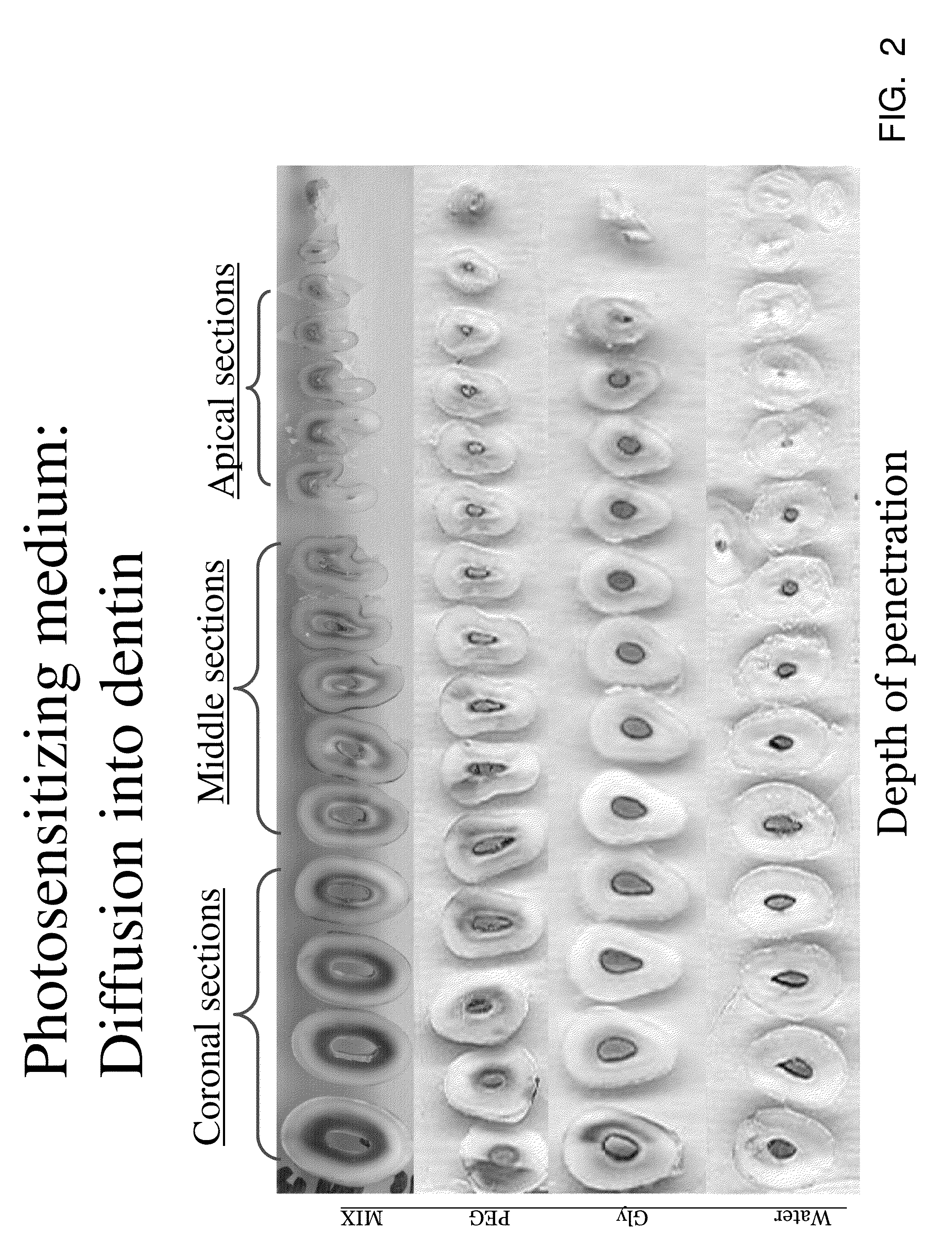 Photo-chemically activated micro-bubble based root canal disinfection