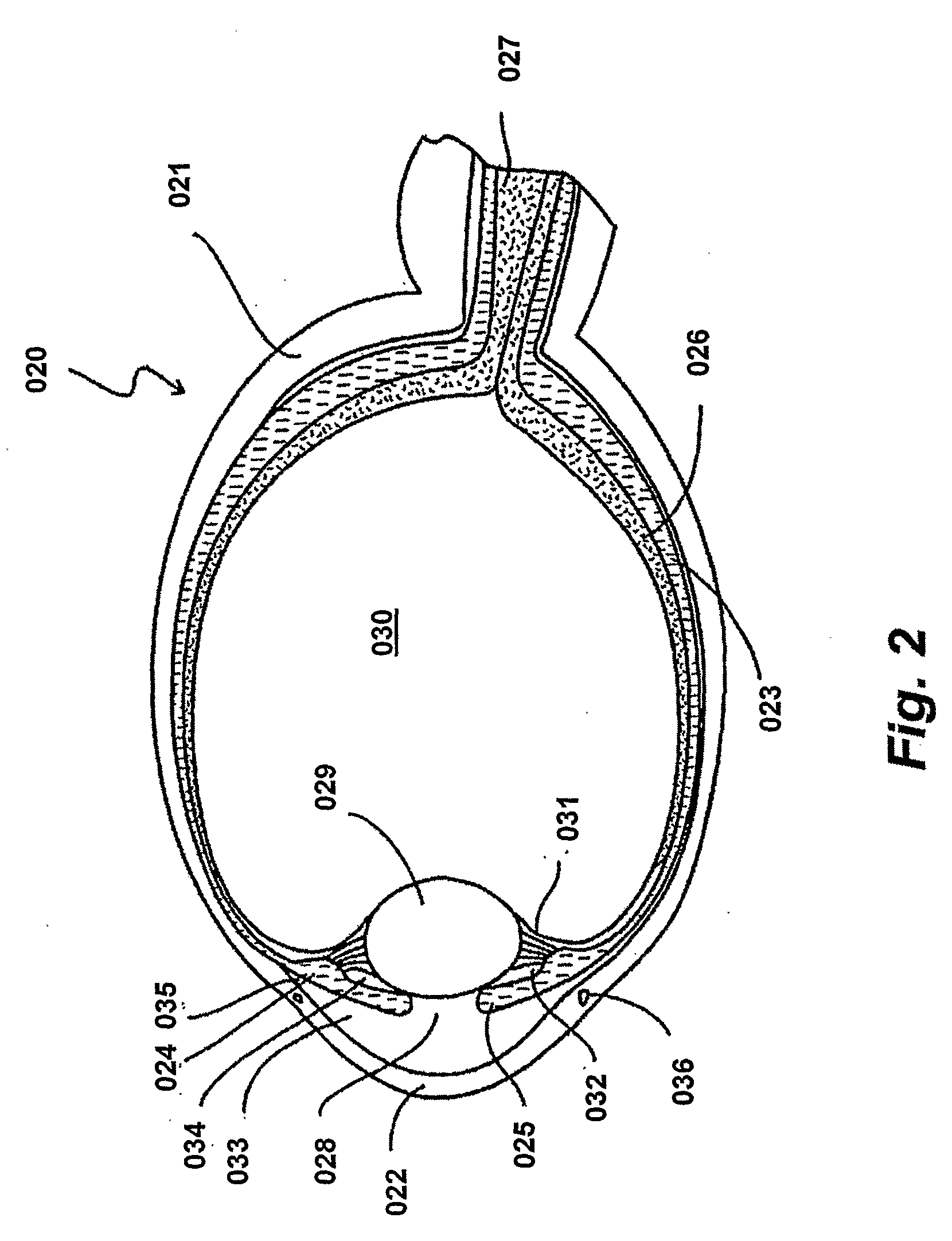 Foldable Intraocular Lens With Adaptable Haptics